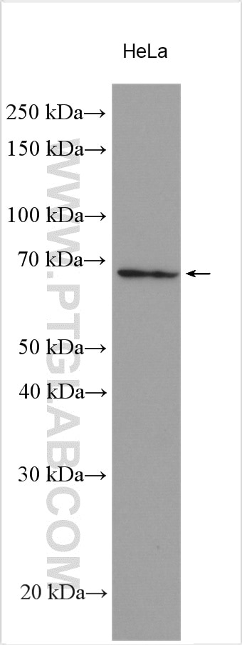 Western Blot (WB) analysis of various lysates using Frizzled 9 Polyclonal antibody (13865-1-AP)