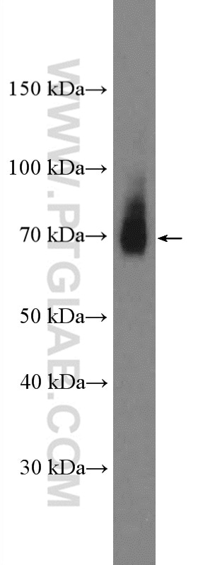 Western Blot (WB) analysis of HeLa cells using Frizzled 9 Polyclonal antibody (13865-1-AP)