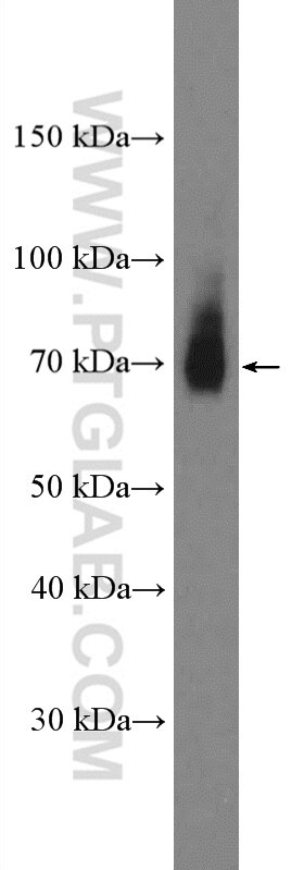 WB analysis of HeLa using 13865-1-AP