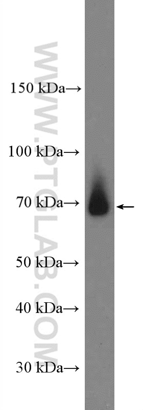 Western Blot (WB) analysis of mouse brain tissue using Frizzled 9 Polyclonal antibody (13865-1-AP)