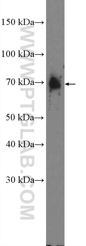 Western Blot (WB) analysis of mouse eye tissue using Frizzled 9 Polyclonal antibody (13865-1-AP)