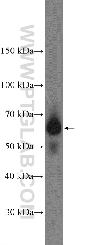 Western Blot (WB) analysis of HUVEC cells using Frizzled 9 Polyclonal antibody (13865-1-AP)