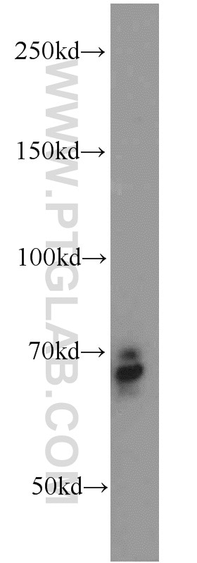 Western Blot (WB) analysis of mouse skeletal muscle tissue using Frizzled 9 Polyclonal antibody (13865-1-AP)