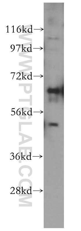 Western Blot (WB) analysis of mouse testis tissue using Frizzled 9 Polyclonal antibody (13865-1-AP)