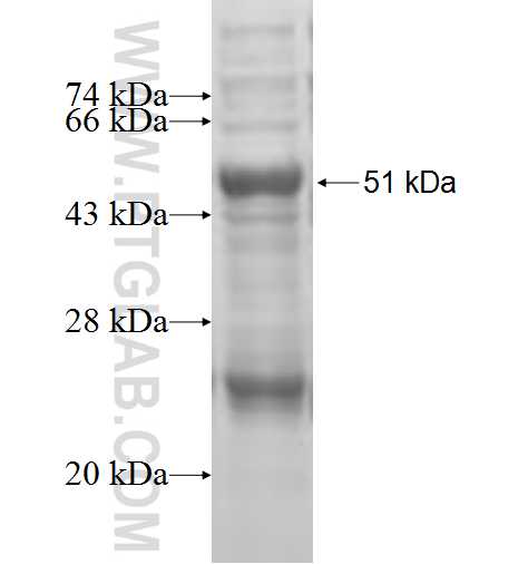 FZD9 fusion protein Ag4847 SDS-PAGE