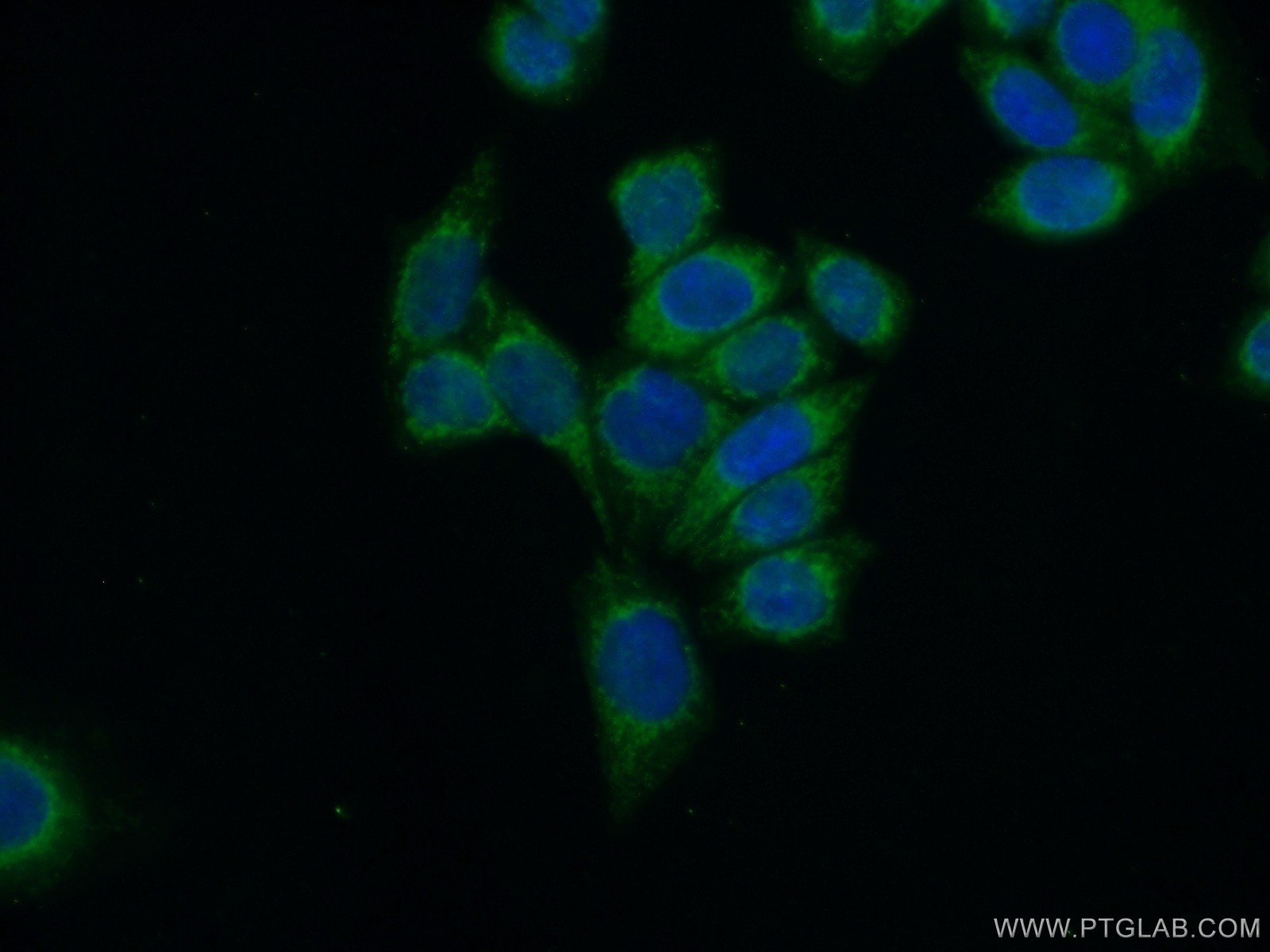 IF Staining of HeLa using 16368-1-AP