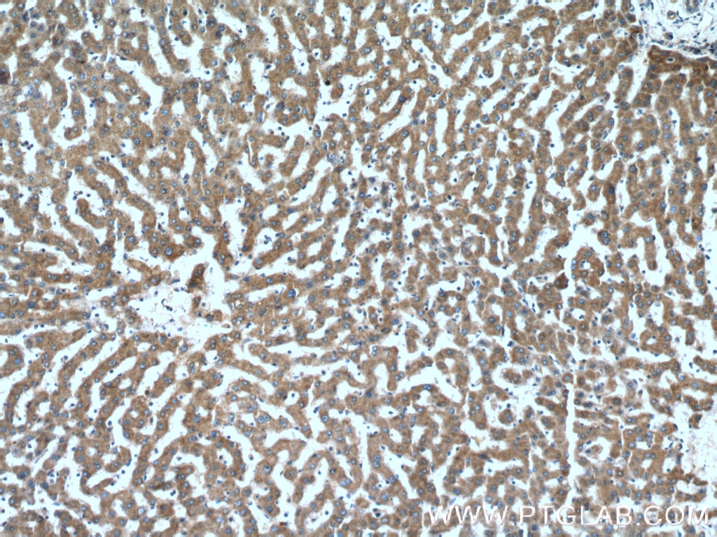 Immunohistochemistry (IHC) staining of human liver tissue using FZR1/Cdh1 Polyclonal antibody (16368-1-AP)