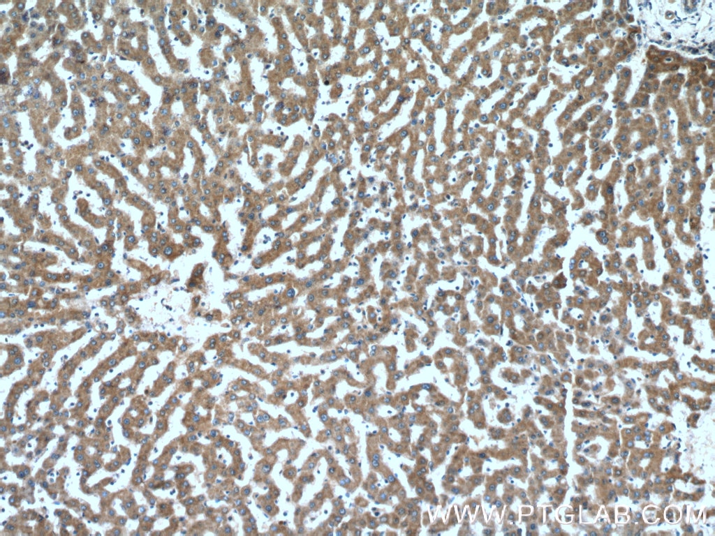 IHC staining of human liver using 16368-1-AP