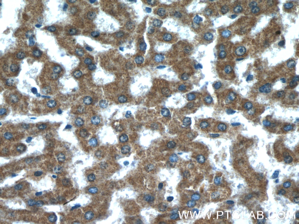 Immunohistochemistry (IHC) staining of human liver tissue using FZR1/Cdh1 Polyclonal antibody (16368-1-AP)