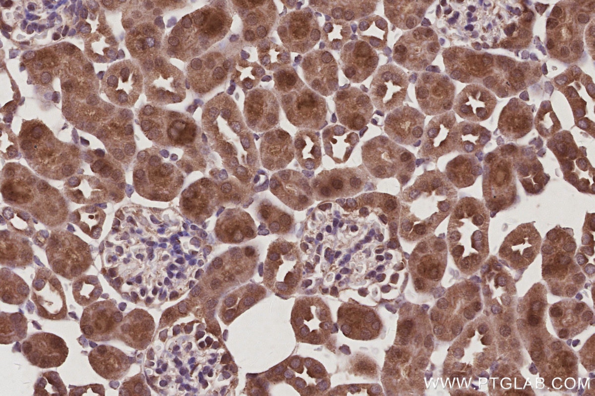 IHC staining of mouse kidney using 16368-1-AP Immunohistochemistry (IHC) staining of mouse kidney tissue using FZR1/Cdh1 Polyclonal antibody (16368-1-AP)