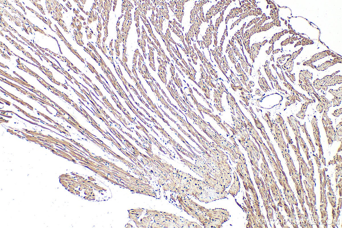 Immunohistochemistry (IHC) staining of mouse heart tissue using FZR1/Cdh1 Polyclonal antibody (16368-1-AP)