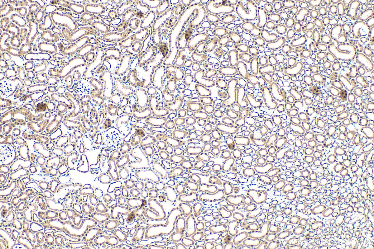 Immunohistochemistry (IHC) staining of mouse kidney tissue using FZR1/Cdh1 Polyclonal antibody (16368-1-AP)