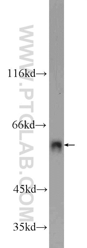 WB analysis of C6 using 16368-1-AP