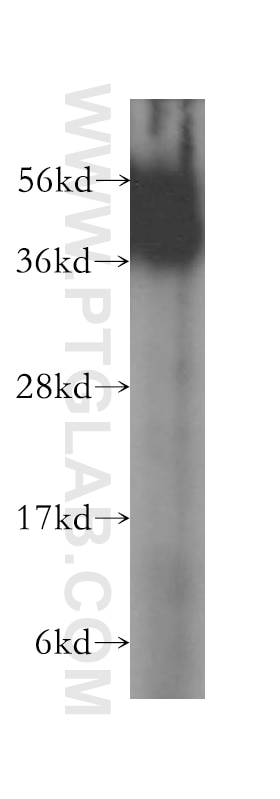 Western Blot (WB) analysis of Jurkat cells using FZR1/Cdh1 Polyclonal antibody (16368-1-AP)