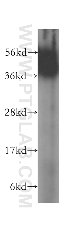WB analysis of Jurkat using 16368-1-AP