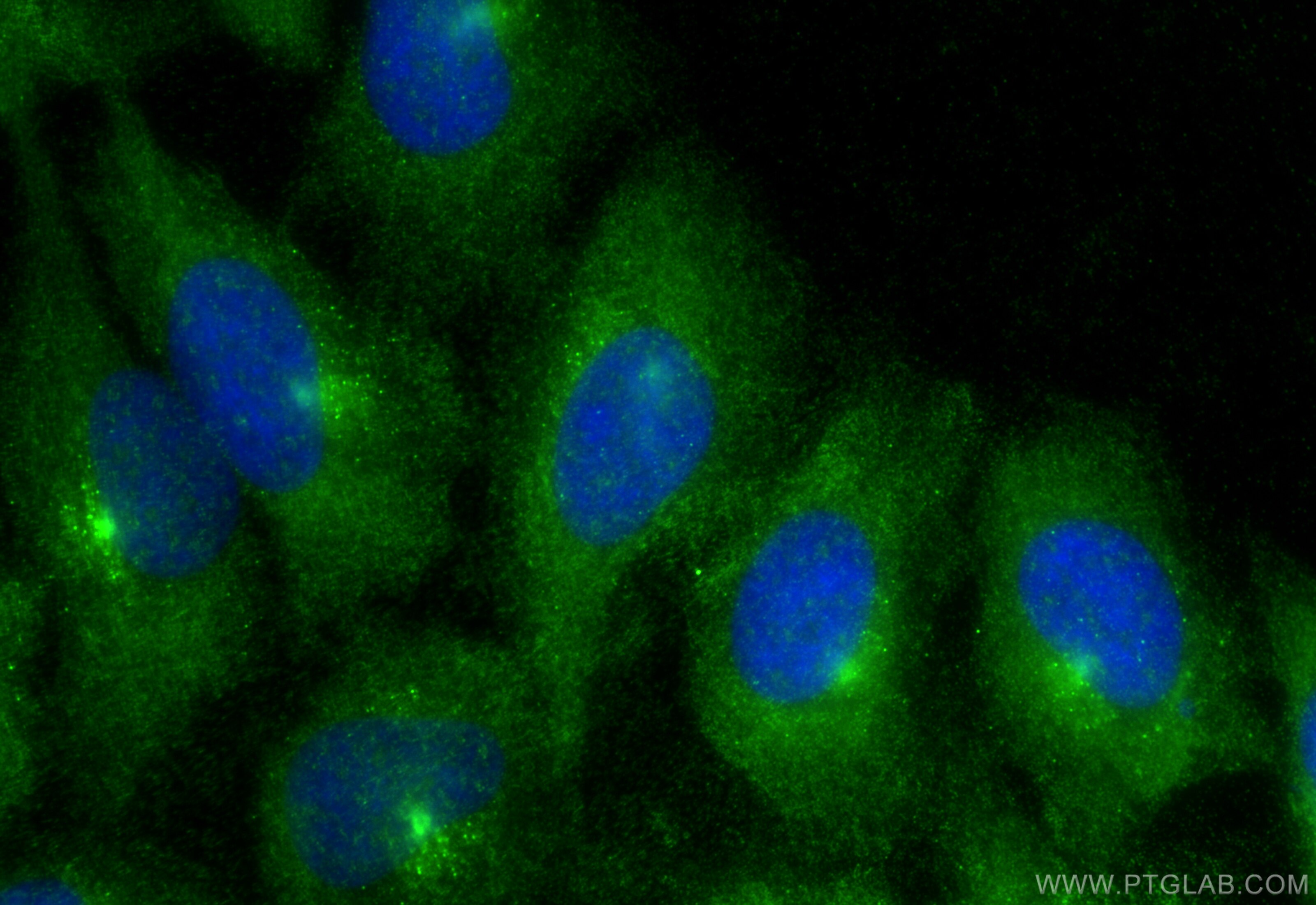 Immunofluorescent analysis of (-20°C Ethanol) fixed HeLa cells using Factor IX/PTC antibody (32051-1-AP) at dilution of 1:400 and CoraLite®488-Conjugated Goat Anti-Rabbit IgG(H+L) (SA00013-2). Immunofluorescence (IF) / fluorescent staining of HeLa cells using Factor IX/PTC Polyclonal antibody (32051-1-AP)