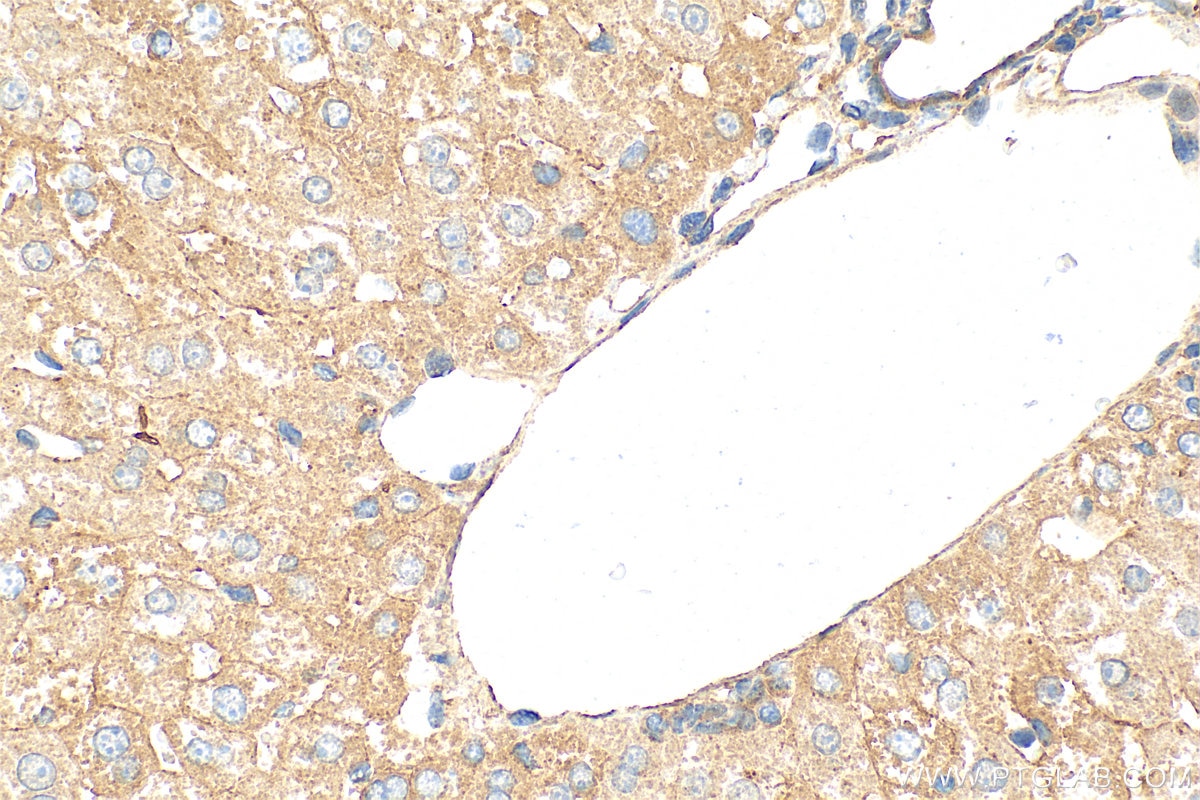 Immunohistochemistry (IHC) staining of mouse liver tissue using Factor IX/PTC Polyclonal antibody (32051-1-AP)
