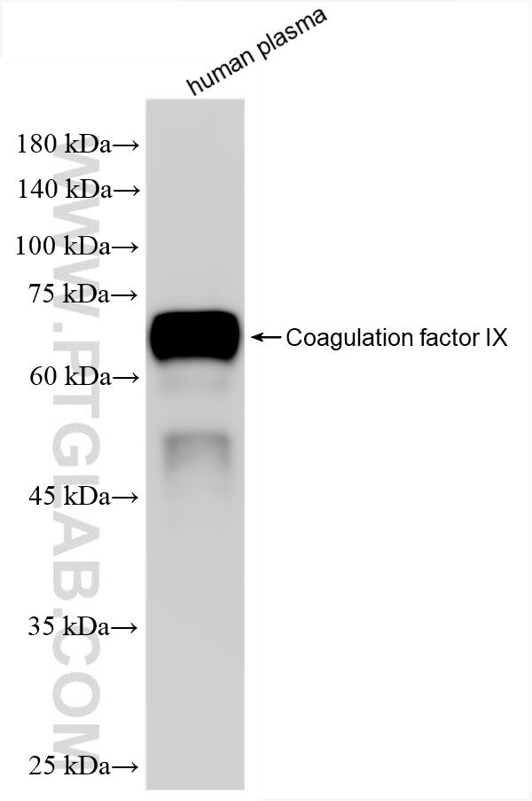 Factor IX/PTC