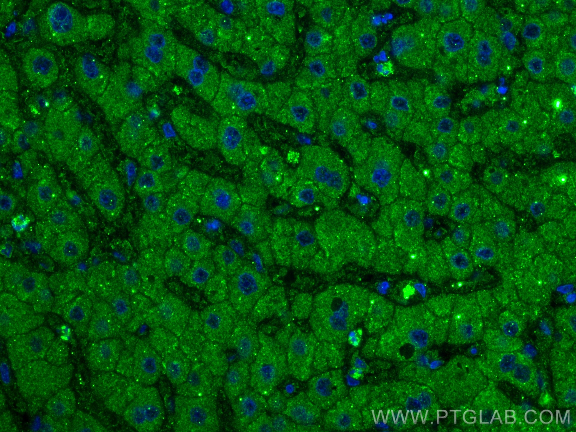 Immunofluorescence (IF) / fluorescent staining of human liver tissue using Factor X Monoclonal antibody (66753-1-Ig)