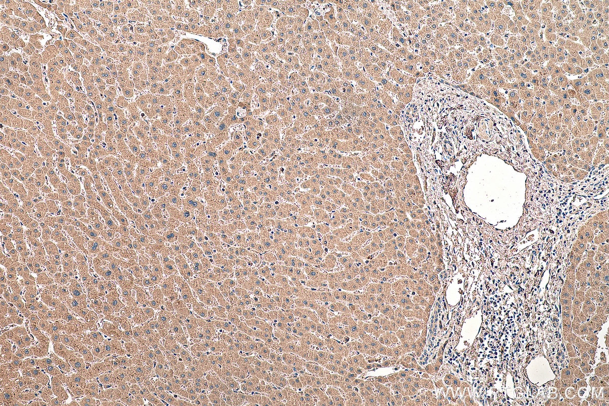 Immunohistochemistry (IHC) staining of human liver tissue using Factor X Monoclonal antibody (66753-1-Ig)