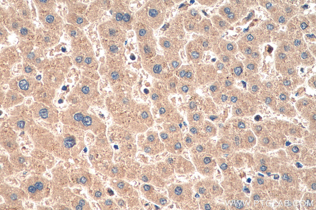 Immunohistochemistry (IHC) staining of human liver tissue using Factor X Monoclonal antibody (66753-1-Ig)