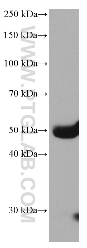 Western Blot (WB) analysis of human plasma using Factor X Monoclonal antibody (66753-1-Ig)