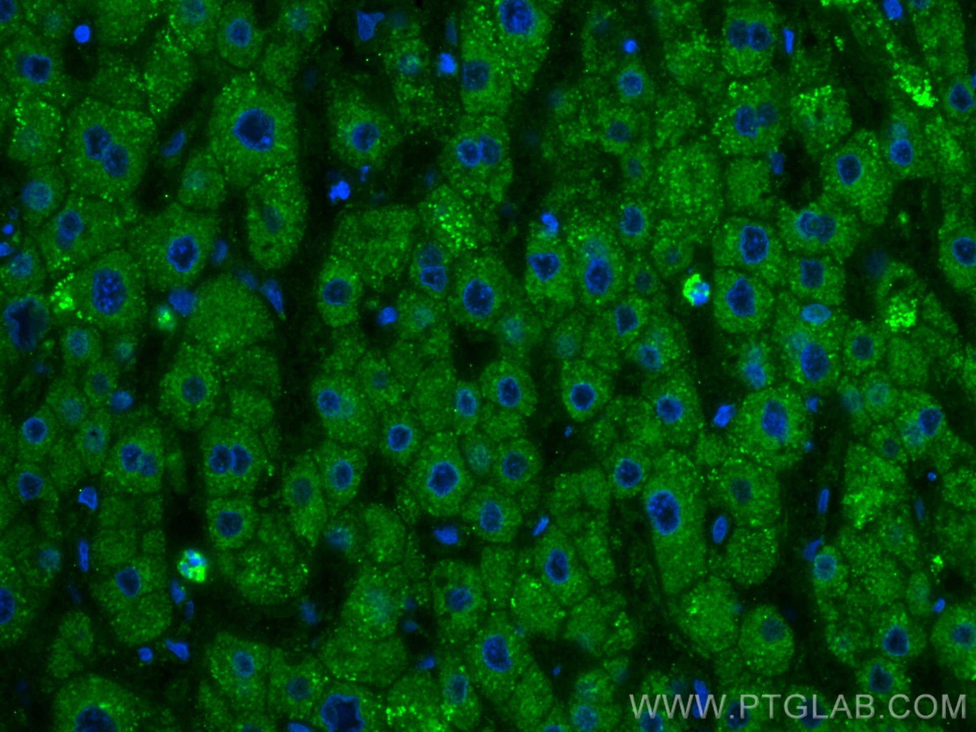 Immunofluorescence (IF) / fluorescent staining of human liver tissue using CoraLite® Plus 488-conjugated Factor X Monoclonal  (CL488-66753)