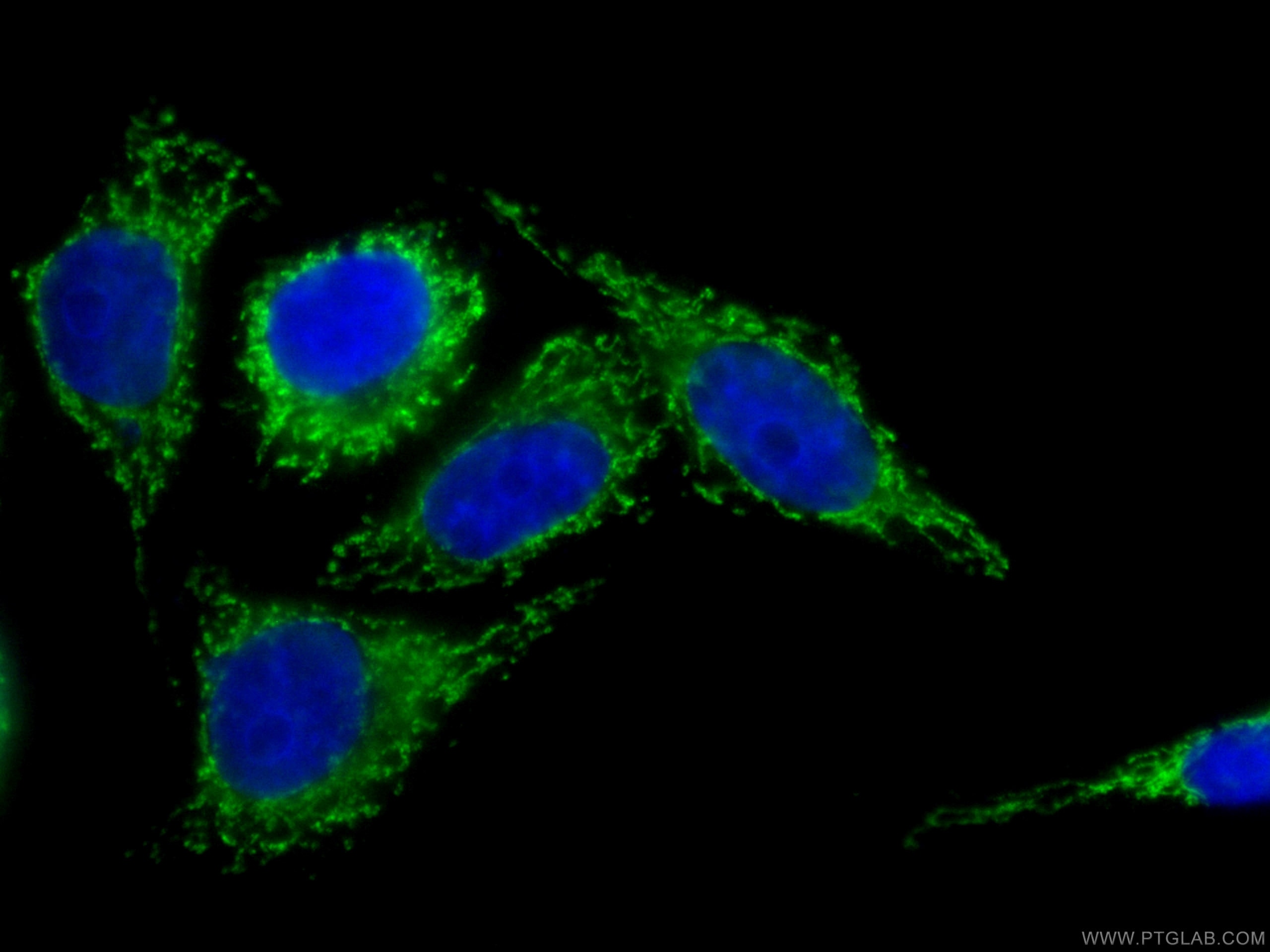 Immunofluorescence (IF) / fluorescent staining of HepG2 cells using CoraLite® Plus 488-conjugated Factor XII Monoclona (CL488-66089)