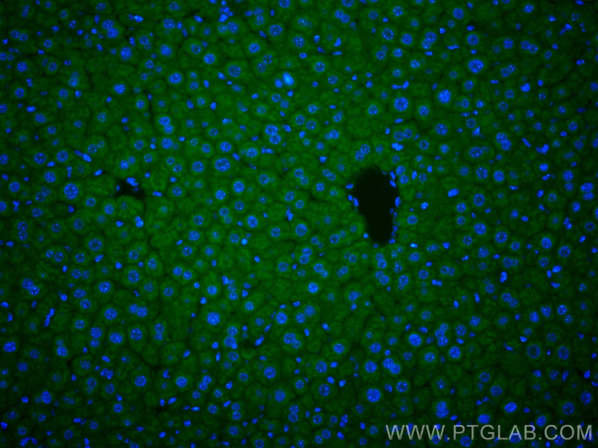 Immunofluorescence (IF) / fluorescent staining of mouse liver tissue using CoraLite® Plus 488-conjugated Factor XII Monoclona (CL488-66089)