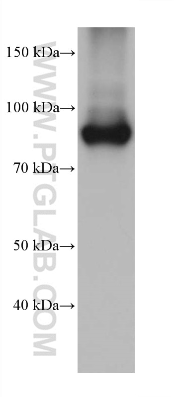 Western Blot (WB) analysis of human peripheral blood platelets using Factor XIIIa Monoclonal antibody (66325-1-Ig)