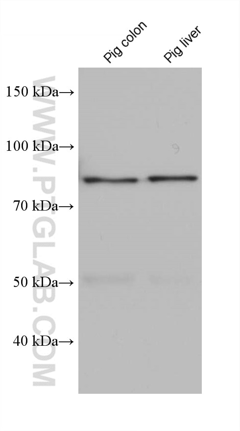 Western Blot (WB) analysis of various lysates using Factor XIIIa Monoclonal antibody (66325-1-Ig)