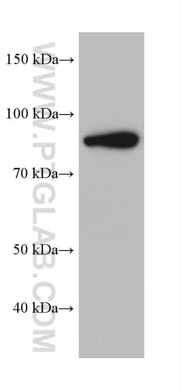 Western Blot (WB) analysis of rat colon tissue using Factor XIIIa Monoclonal antibody (66325-1-Ig)