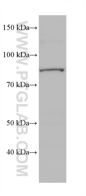 Western Blot (WB) analysis of rabbit large intestine tissue using Factor XIIIa Monoclonal antibody (66325-1-Ig)