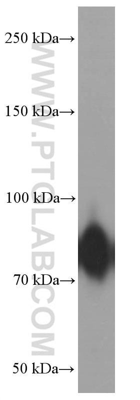 Western Blot (WB) analysis of human placenta tissue using Factor XIIIa Monoclonal antibody (66325-1-Ig)