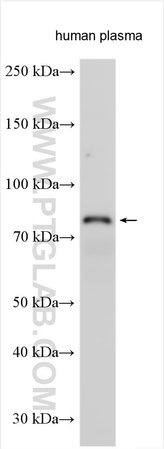 Western Blot (WB) analysis of human plasma using Factor XIIIb Polyclonal antibody (20269-1-AP)