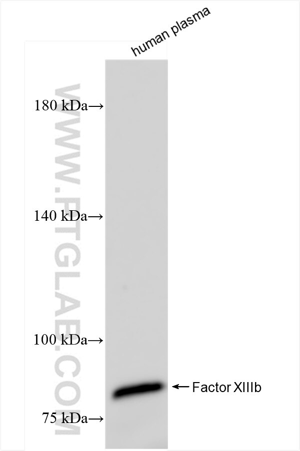 Western Blot (WB) analysis of human plasma using Factor XIIIb Recombinant antibody (84273-1-RR)
