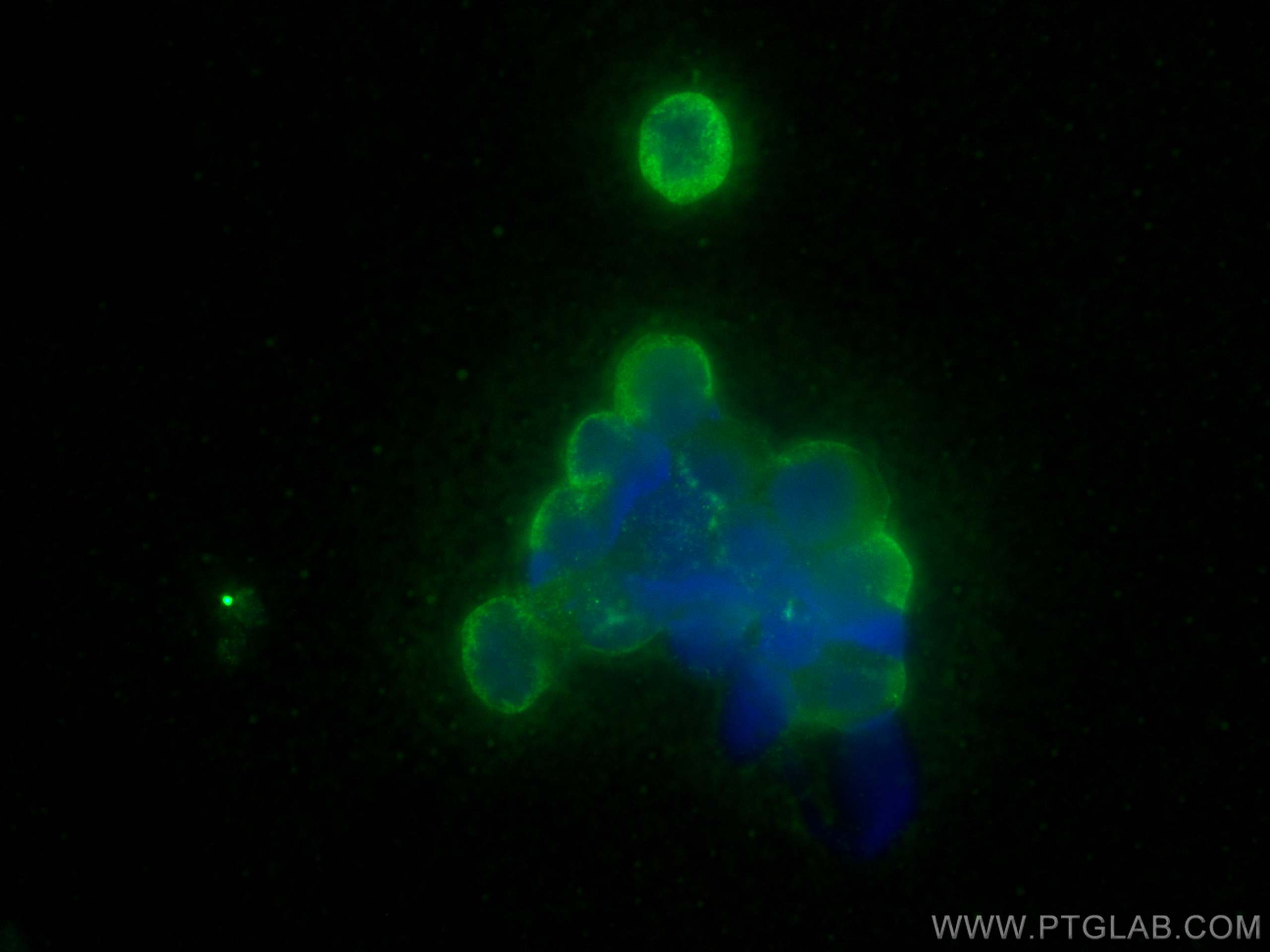 Immunofluorescence (IF) / fluorescent staining of Raji cells using Fas/CD95 Polyclonal antibody (30601-1-AP)