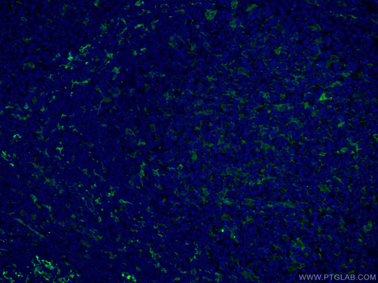 Immunofluorescence (IF) / fluorescent staining of human tonsillitis tissue using Fascin Monoclonal antibody (66321-1-Ig)