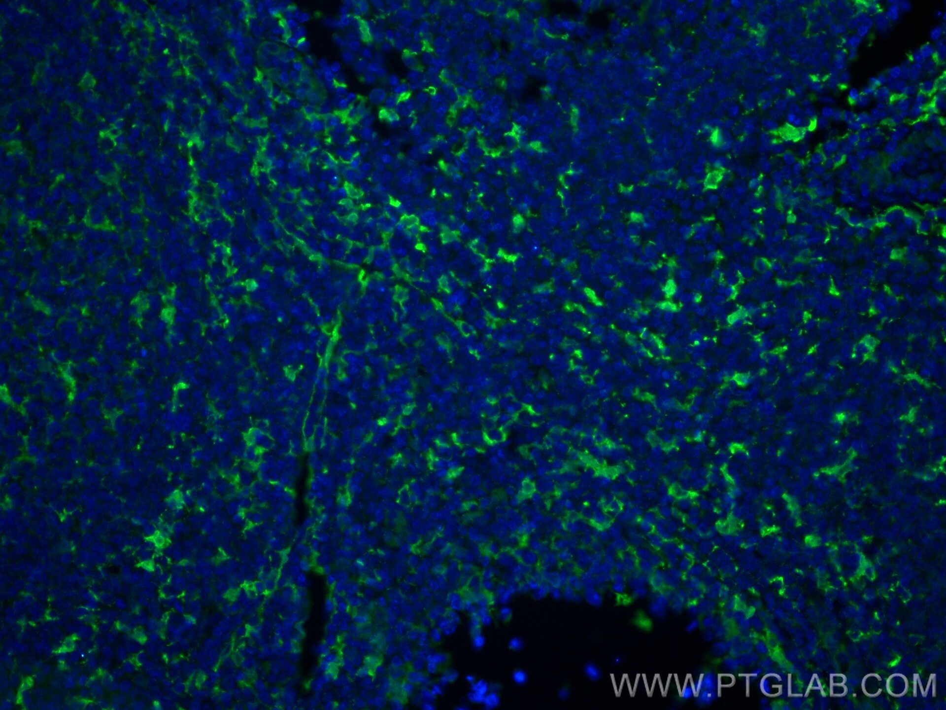 Immunofluorescence (IF) / fluorescent staining of human tonsillitis tissue using Fascin Monoclonal antibody (66321-1-Ig)