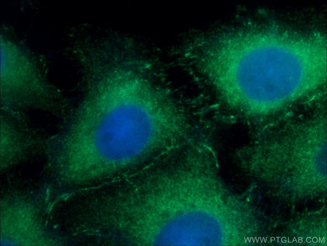 Immunofluorescence (IF) / fluorescent staining of SH-SY5Y cells using Fascin Monoclonal antibody (66321-1-Ig)