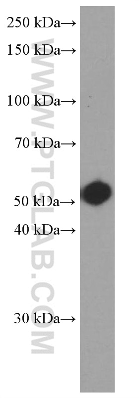 Western Blot (WB) analysis of SH-SY5Y cells using Fascin Monoclonal antibody (66321-1-Ig)