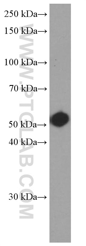 WB analysis of SH-SY5Y using 66321-1-Ig