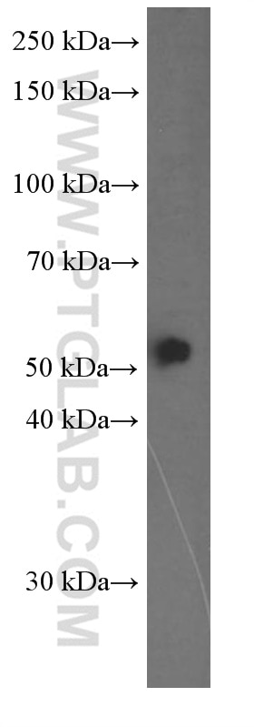 Western Blot (WB) analysis of K-562 cells using Fascin Monoclonal antibody (66321-1-Ig)