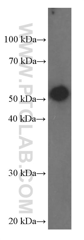 Western Blot (WB) analysis of HeLa cells using Fascin Monoclonal antibody (66321-1-Ig)