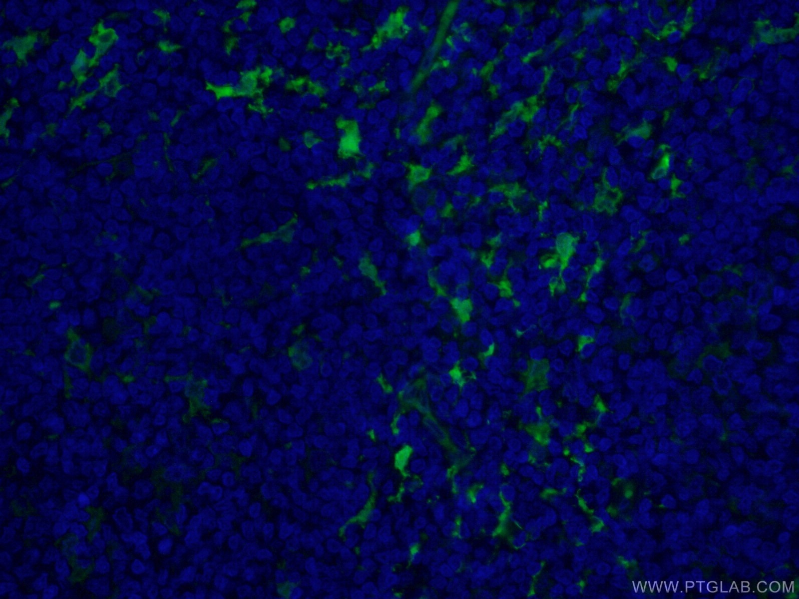 Immunofluorescence (IF) / fluorescent staining of human tonsillitis tissue using CoraLite® Plus 488-conjugated Fascin Monoclonal an (CL488-66321)