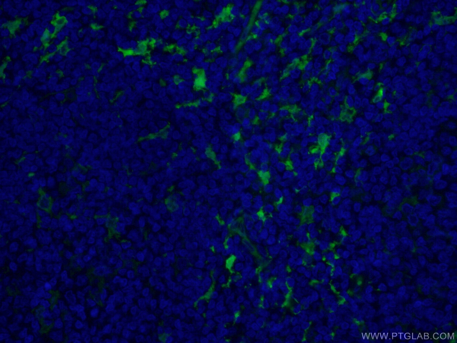 IF Staining of human tonsillitis using CL488-66321