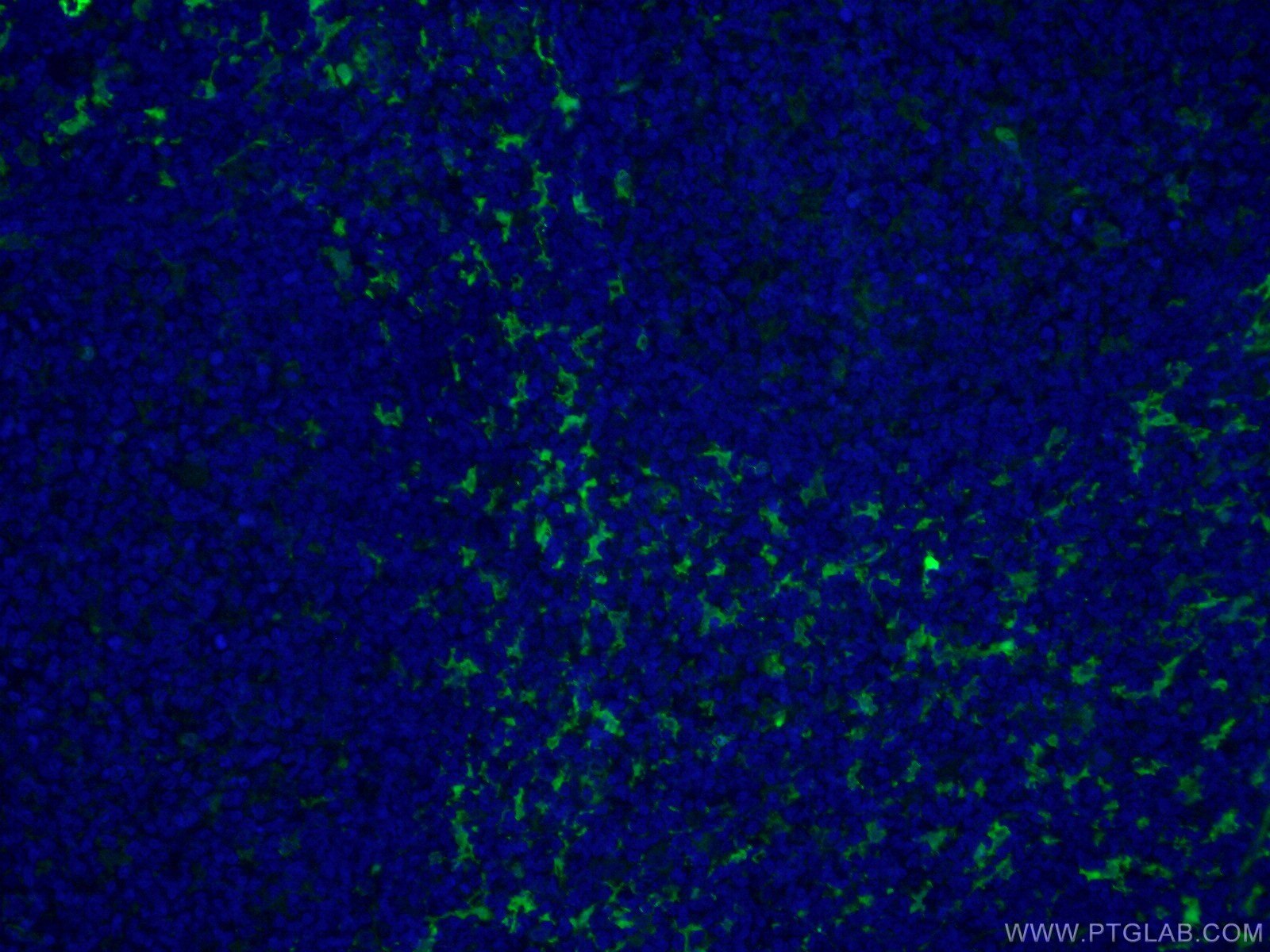 Immunofluorescence (IF) / fluorescent staining of human tonsillitis tissue using CoraLite® Plus 488-conjugated Fascin Monoclonal an (CL488-66321)