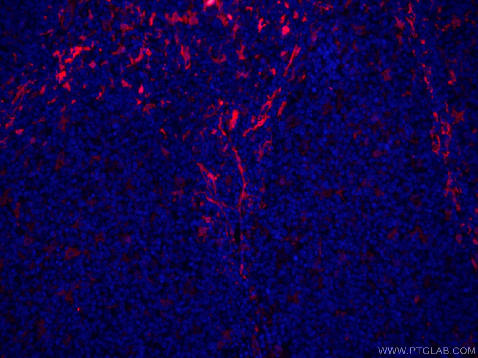 Immunofluorescence (IF) / fluorescent staining of human tonsillitis tissue using CoraLite®594-conjugated Fascin Monoclonal antibody (CL594-66321)