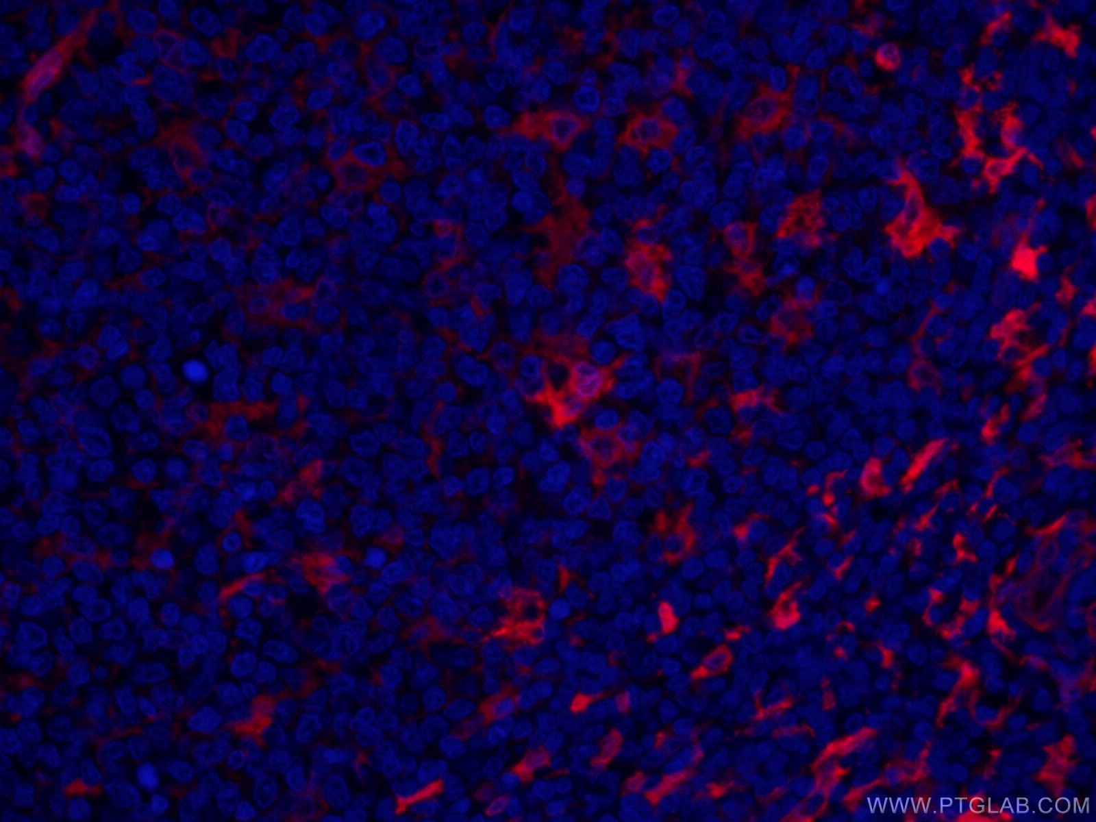 Immunofluorescence (IF) / fluorescent staining of human tonsillitis tissue using CoraLite®594-conjugated Fascin Monoclonal antibody (CL594-66321)