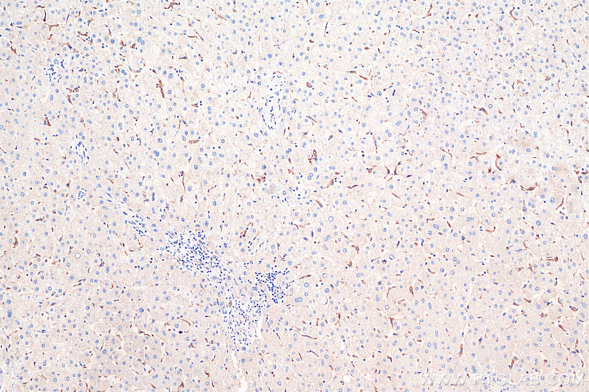 Immunohistochemistry (IHC) staining of human liver tissue using FcRn Monoclonal antibody (67944-1-Ig)